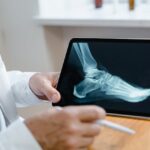 Orthopedie en Podotherapie: begrijpen van de verschillen